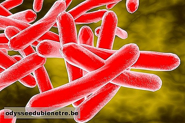O que é Tuberculose ganglionar, Sintomas, contágio e Tratamento