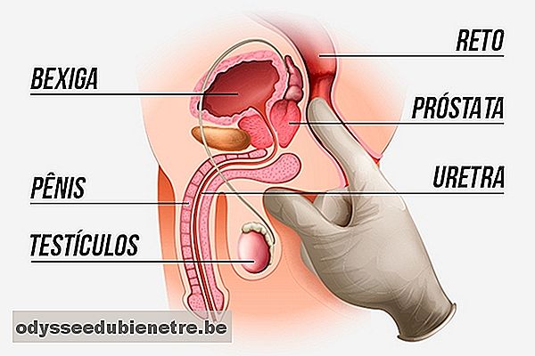 Durere dincolo de prostata | sincanoua.ro