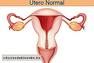 Sistema reprodutor feminino normal
