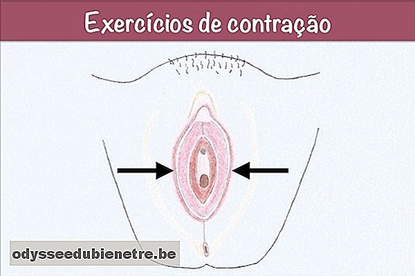 Fazer exercícios de contração da vagina ajuda a diminuir a flacidez