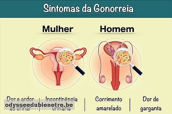 Sintomas da gonorreia