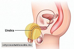 Inflamação na uretra
