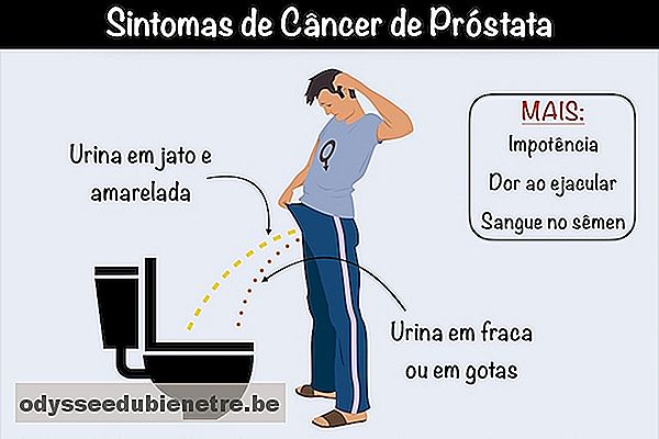 10 sinais que podem indicar Câncer de Próstata