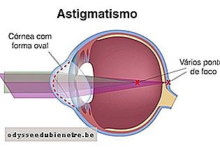 Forma da córnea no astigmatismo