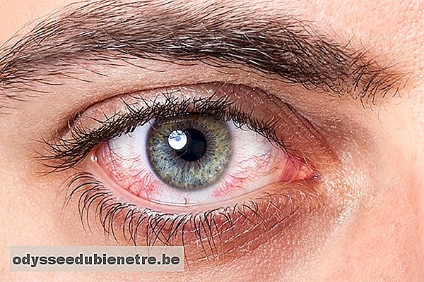 O que os olhos podem dizer sobre sua saúde