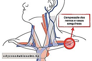 Compressão dos nervos e vasos sanguíneos