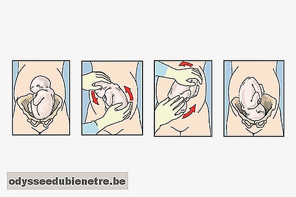 3 exercícios para ajudar o feto a virar de cabeça para baixo