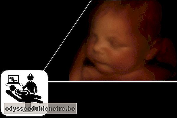 Imagem de bebê em ultrassom 3D