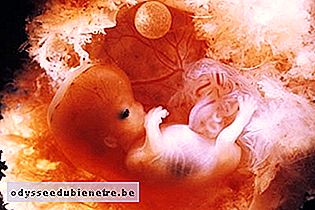 Developpement Du Bebe 10 Semaines De Gestation Odysseedubienetre Be