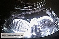 Desenvolvimento do bebê - 22 semanas de gestação