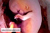 Desenvolvimento do bebê - 8 semanas de gestação
