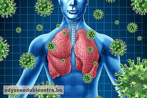 Principais sintomas e causas da pneumonia viral