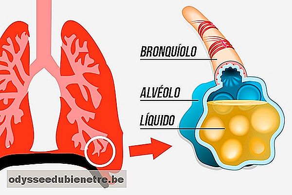 O que pode causar água no pulmão e como tratar