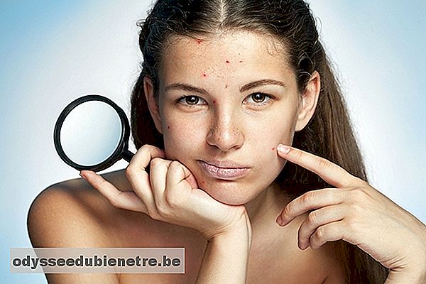 Como identificar e tratar as 7 Doenças de pele mais comuns no Verão