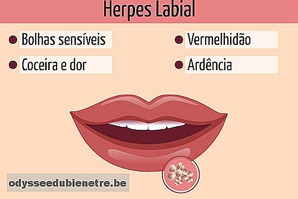 Principais sintomas de herpes na boca.