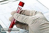 Exame de sangue