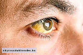 Olhos amarelos