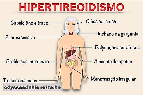 Sintomas de Hipertireoidismo