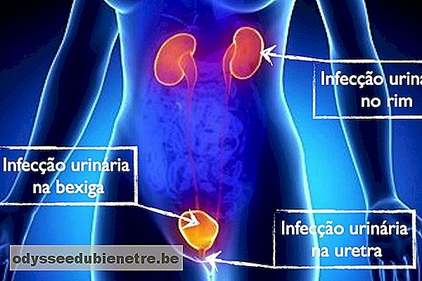 Sintomas de infecção urinária